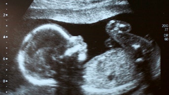 Appeals court rules Texas ERs not bound by Biden admin’s abortion guidance