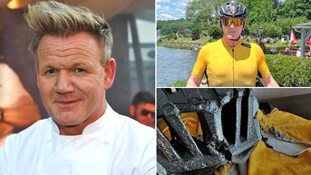 Gordon Ramsay shows off gruesome injuries after terrifying accident