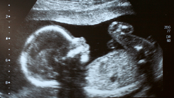 DNC's hellish abortion rituals celebrating the killing of innocent children on full display - Fox News