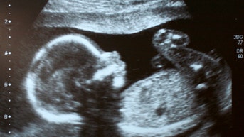 One key thing you do every night is essential to your baby's development, research finds - Fox News