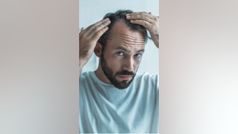 New therapy could HALT hair loss - Fox News