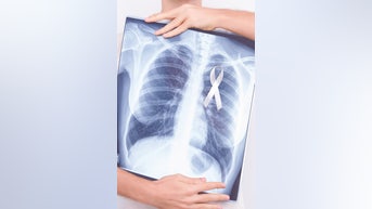 Never smoked? Lung cancer still a RISK - Fox News