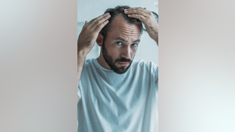 Experimental SERUM could reverse baldness - Fox News