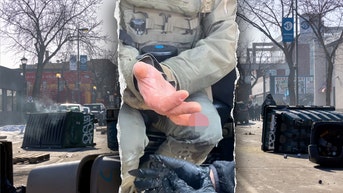 Federal officer’s finger bitten off during Minneapolis unrest, DHS says - Fox News