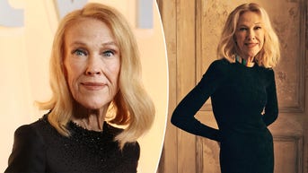 Catherine O'Hara revealed rare medical condition before her death: 'I'm a freak, yeah!' - Fox News