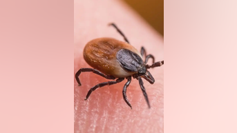 Tick bite ER visits SPIKE as diseases surge - Fox News