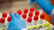 New coronavirus test delivers results within 15 minutes
