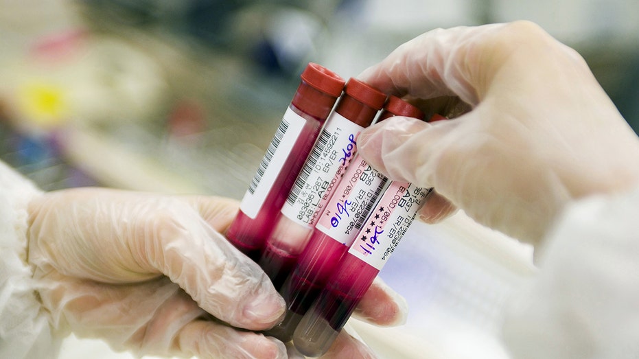 Laboratory technician holding test tubes containing blood samples