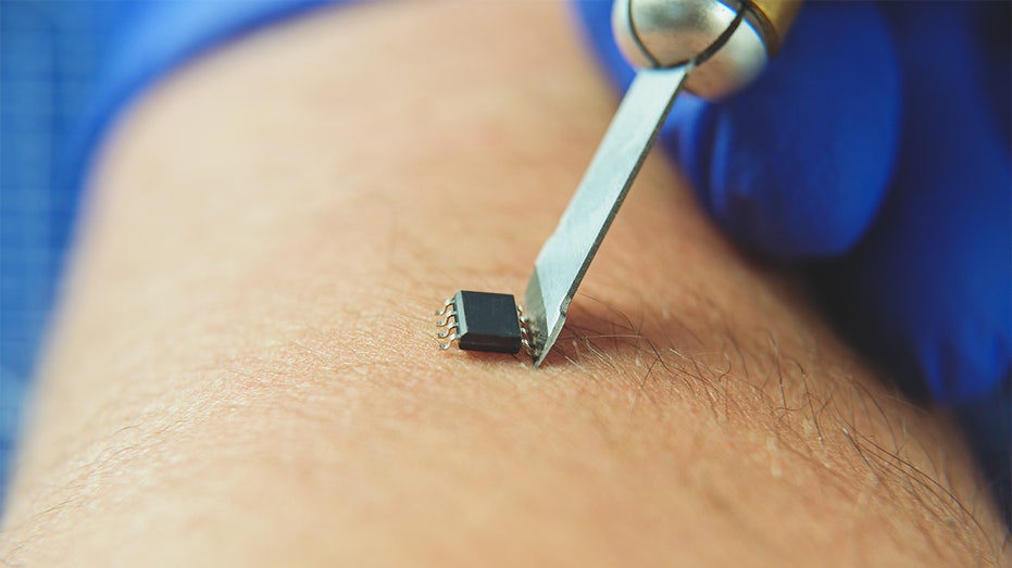 microchip with tweezers