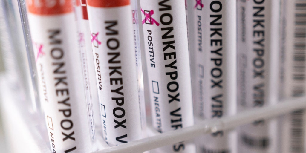 Monkeypox vaccine will be released from US stockpile, CDC says - Vimarsana News