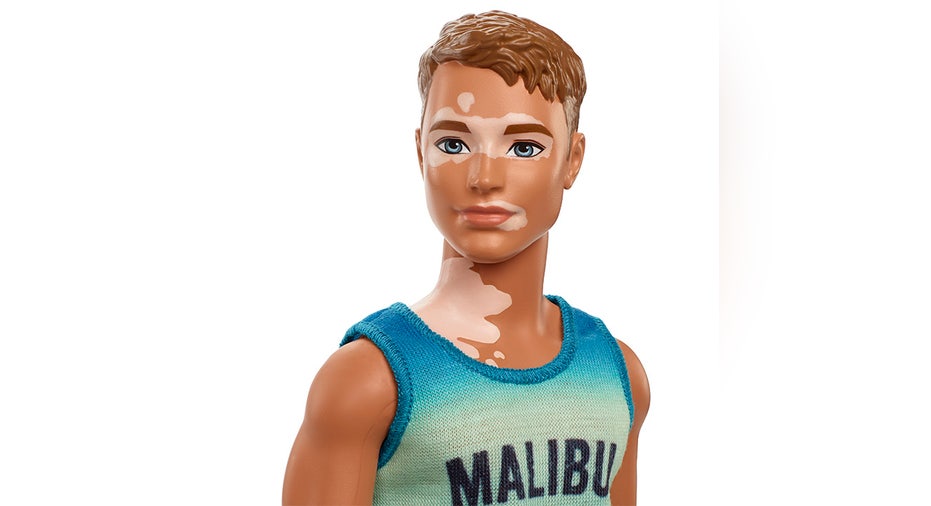 Ken doll with vitiligo