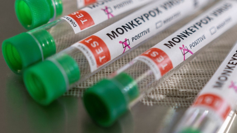 Monkeypox test tubes