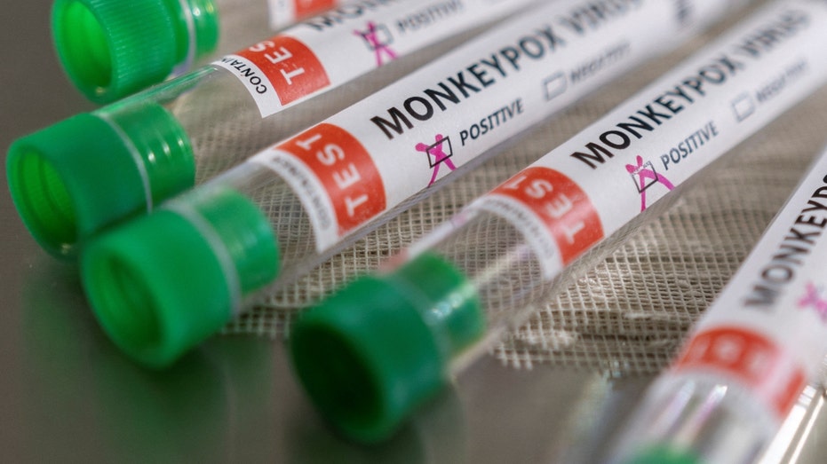 Monkeypox test tubes