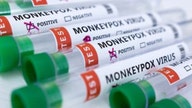 Monkeypox testing expands with launch of first commercial lab