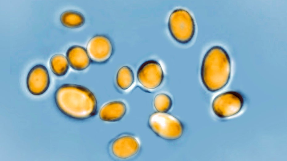 candida auris