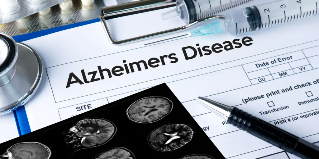 First Alzheimer's disease risk assessment blood test for consumers hits market - Vimarsana News
