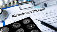 Alzheimer blood test could be game-changer for early detection