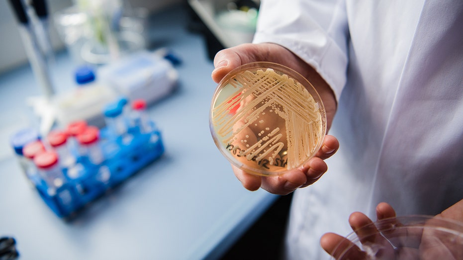 Lab scientist holds Candida auris
