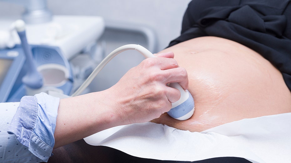 Woman getting an ultrasound