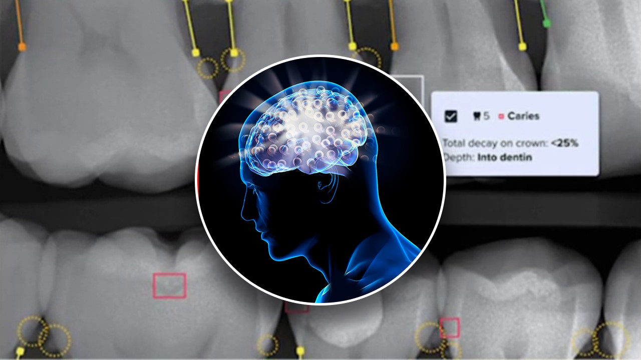 AI match-changer would make leaps toward potential by detecting dental conditions previously than ever: ‘Cutting edge’