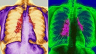 What's your true age? Scientists find way to work out how old you are by studying chest X-rays