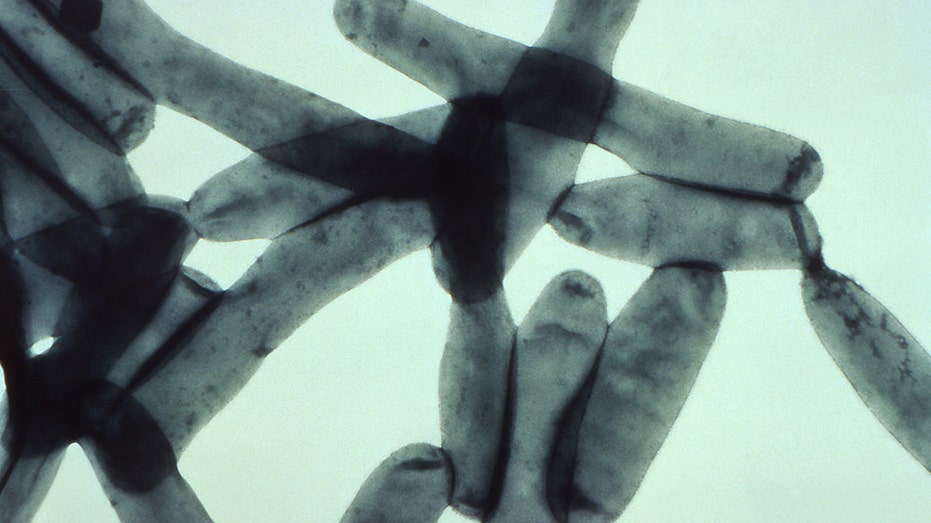 Legionella bacteria