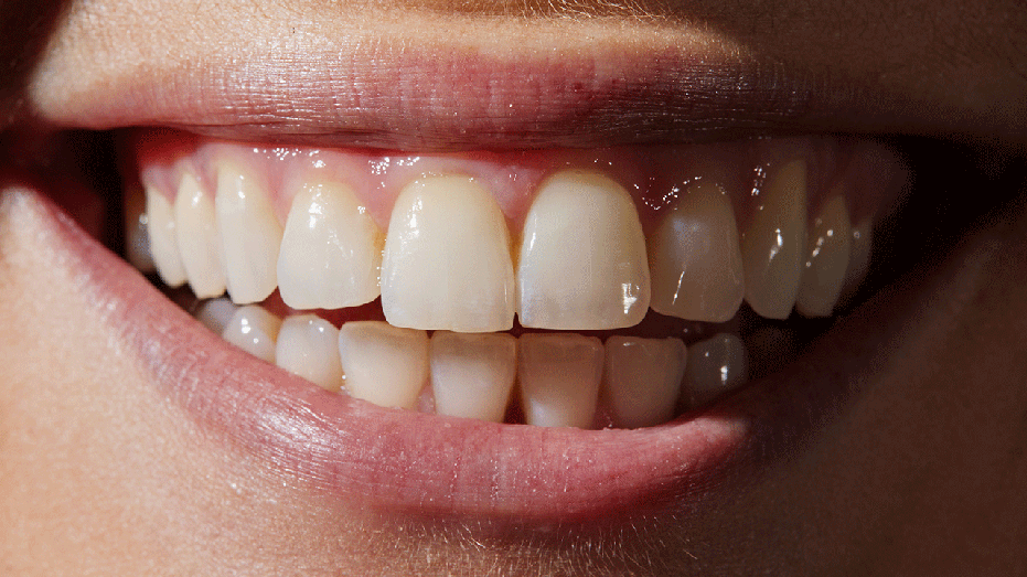 A close-up of person's smile