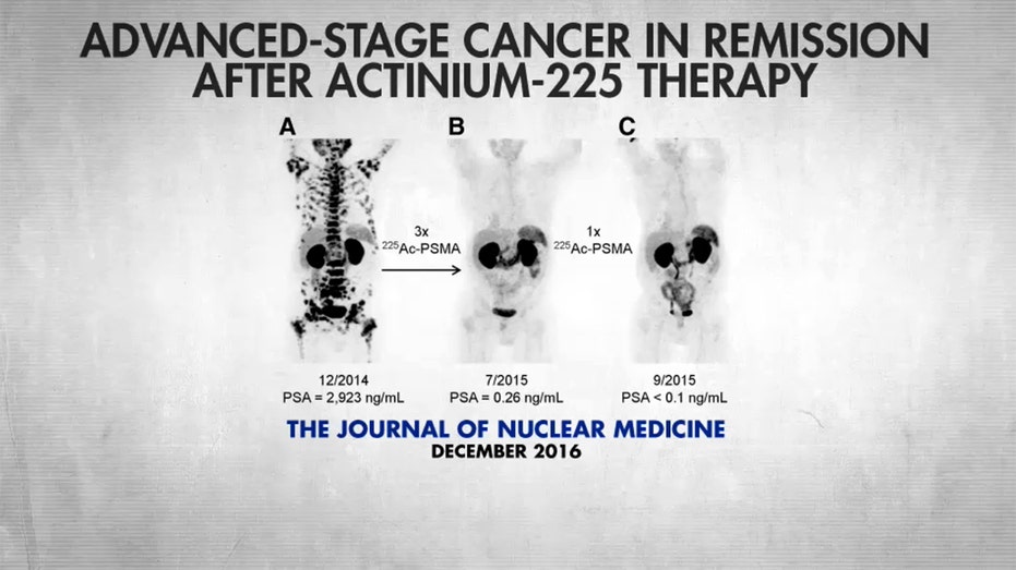A diagram shows the progress of a patient undergoing treatment with actinium-225 for prostate cancer.