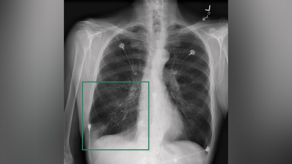 NVIDIA is helping to transform healthcare by powering artificial intelligence (AI) tools that can help in almost every corner of the hospital.