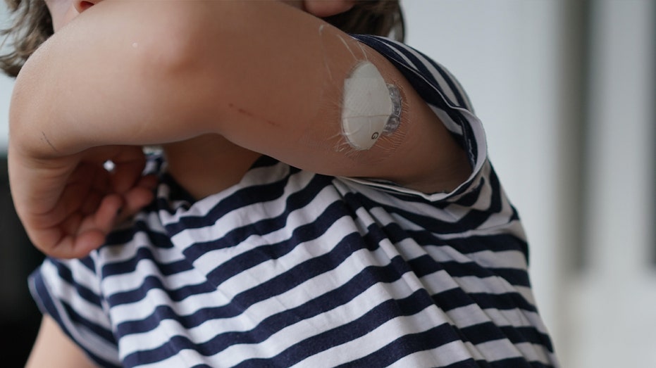 child with glucose monitor the sensor
