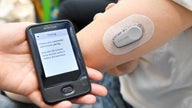FDA commissioner says non-medical-grade wearable data exempt from regulation