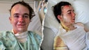 McDonald's worker allegedly doused with hot cooking oil by co-worker, suffers burns over 22% of his body