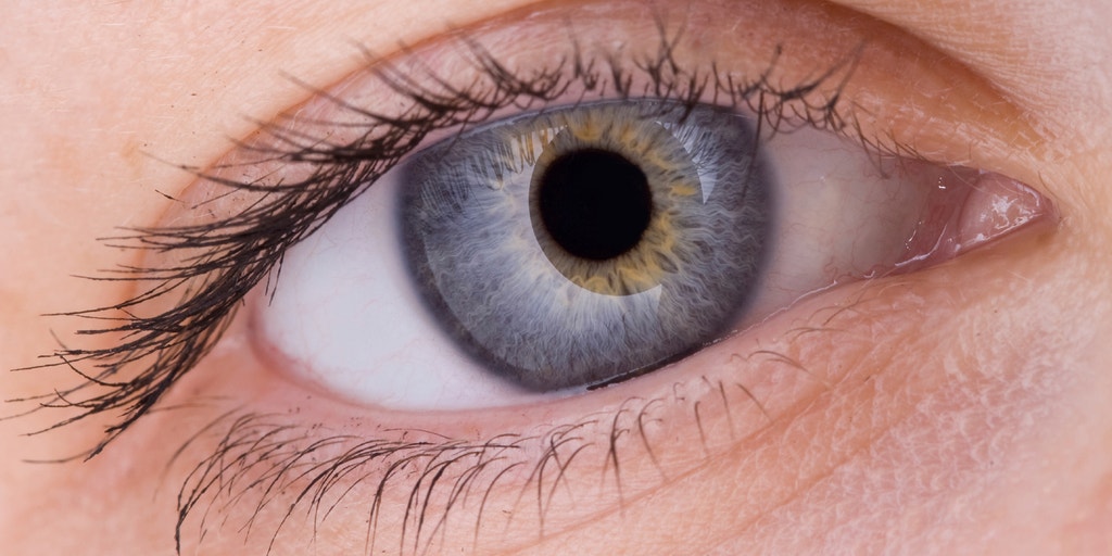 Hiv Dark Ring Around Eye