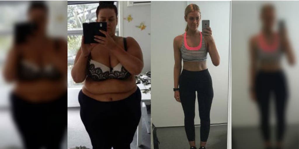 Makeup artist who documented 194-pound weight loss journey on social media  undergoes skin surgery