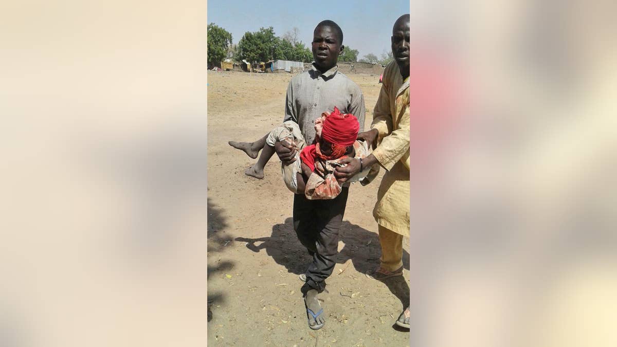 In this image supplied by MSF, a man carries an injured child following a military air strike at a camp for displaced people in Rann, Nigeria, Tuesday Jan. 17, 2017.  Relief volunteers are believed to be among the more than 100 dead after a Nigerian Air Force jet fighter mistakenly bombed the refugee camp, while on a mission against Boko Haram extremists. Medical condition of the child unknown. (Medecins Sans Frontieres (MSF) via AP)