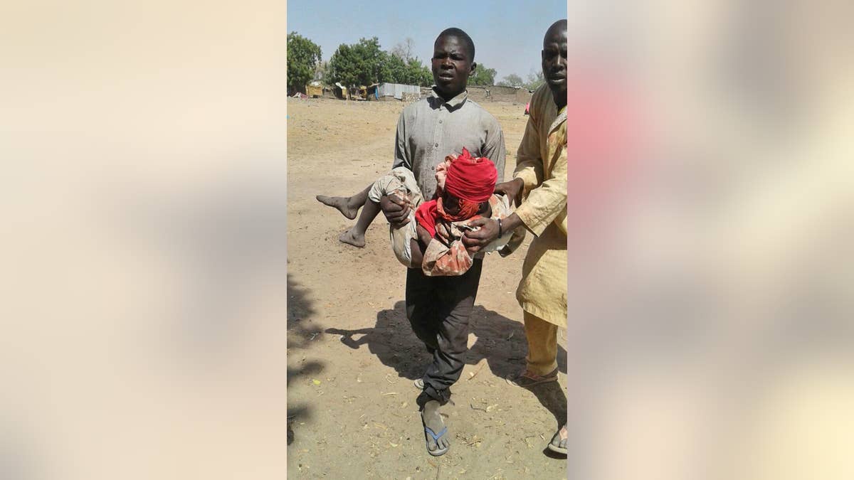 In this image supplied by MSF, a man carries an injured child following a military air strike at a camp for displaced people in Rann, Nigeria, Tuesday Jan. 17, 2017. Relief volunteers are believed to be among the more than 100 dead after a Nigerian Air Force jet fighter mistakenly bombed the refugee camp, while on a mission against Boko Haram extremists. Medical condition of the child unknown. (Medecins Sans Frontieres (MSF) via AP)