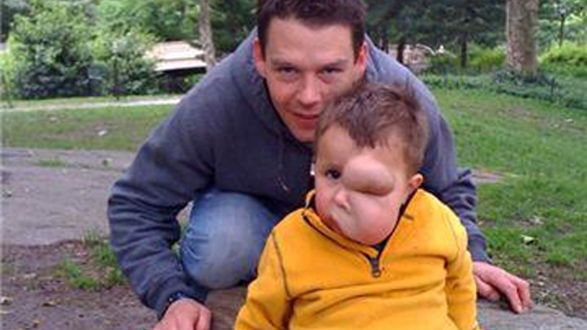 Bocah Kanada datang ke AS untuk menjalani operasi yang mengubah hidupnya