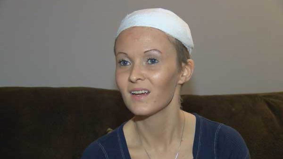 kentucky scalp woman 39