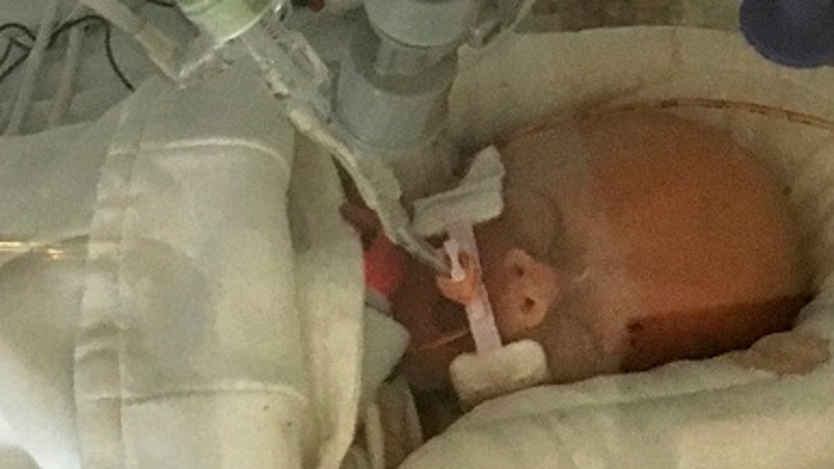 Baby Whose Mother Chose To Give Birth Over Chemotherapy Dies | Fox News