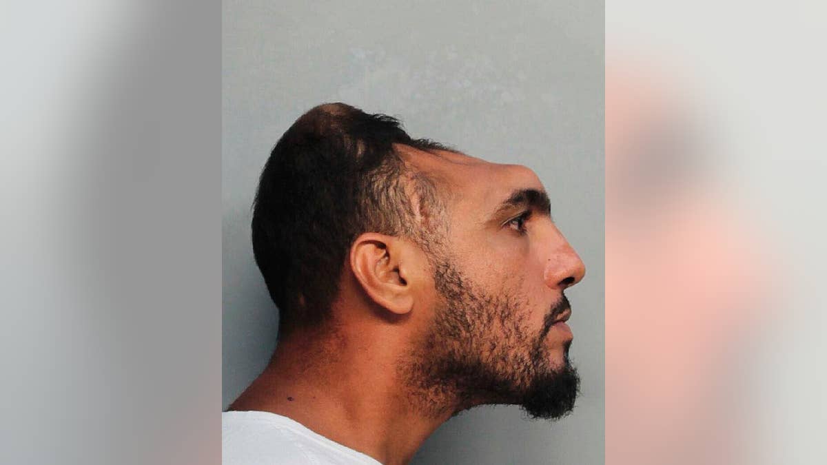 Police: Half-headed Florida man tried to burn down house