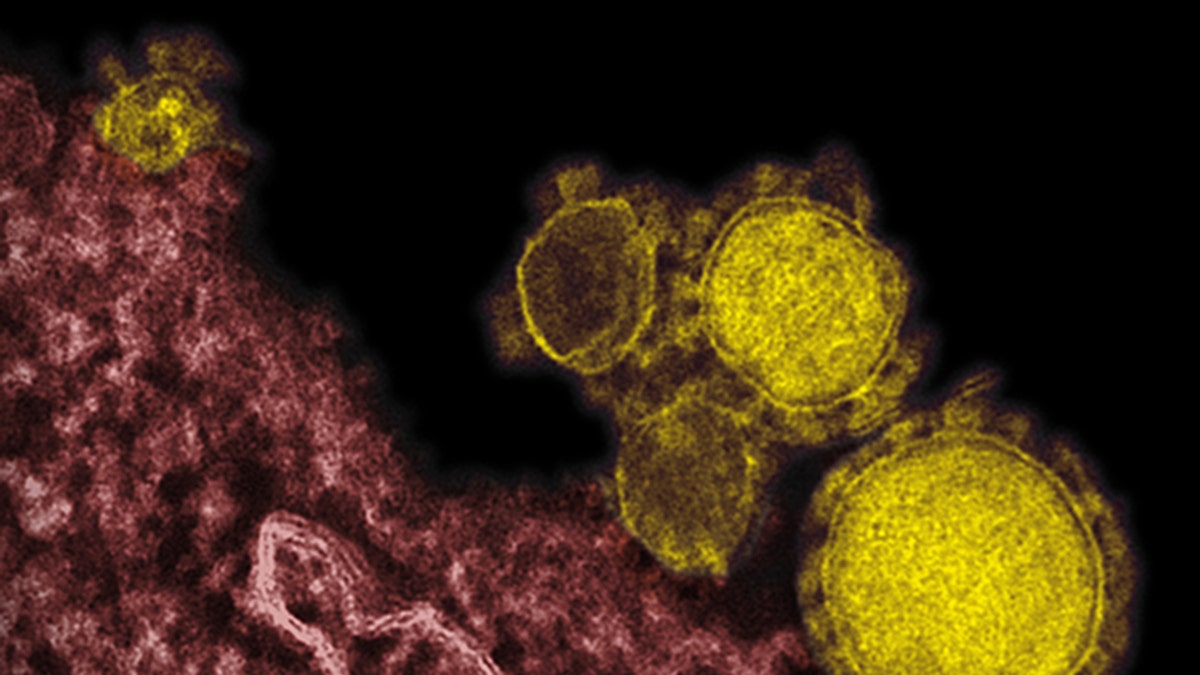 3e2b7646-MERS Virus Saudi Outbreak