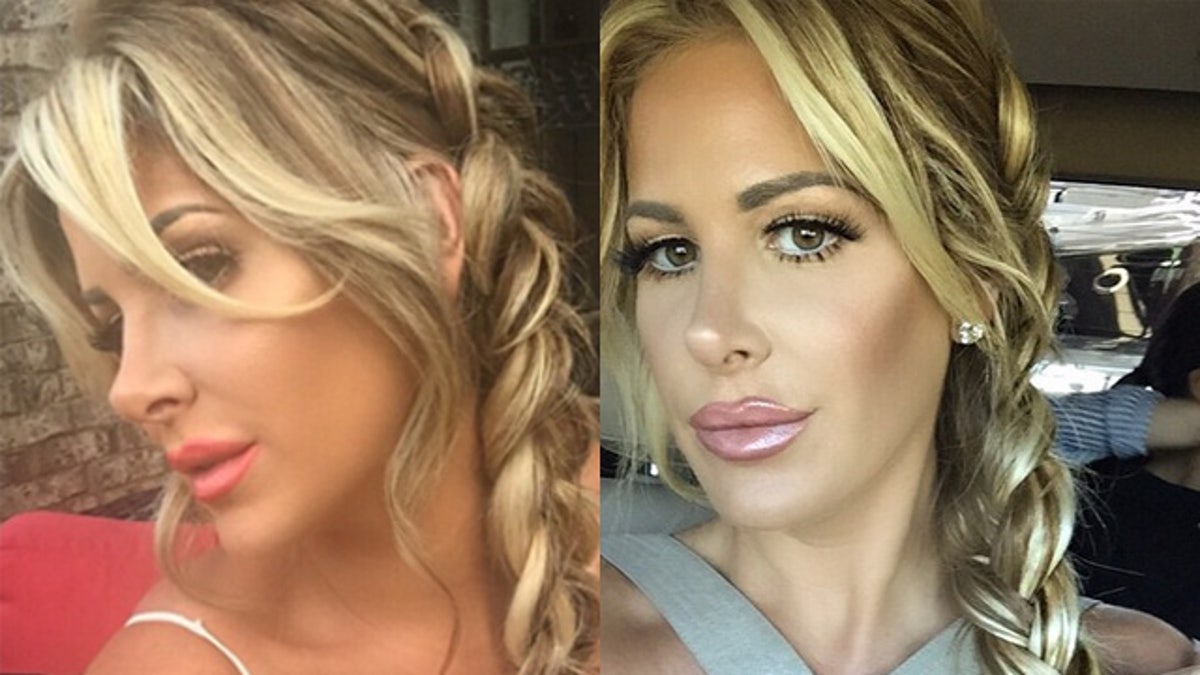 Kim Zolciak denies having any plastic surgery on her face Fox News