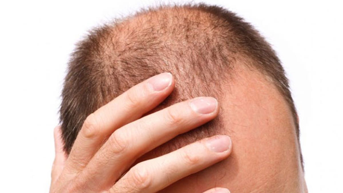волосы на груди у мужчин выпадают волосы фото 15