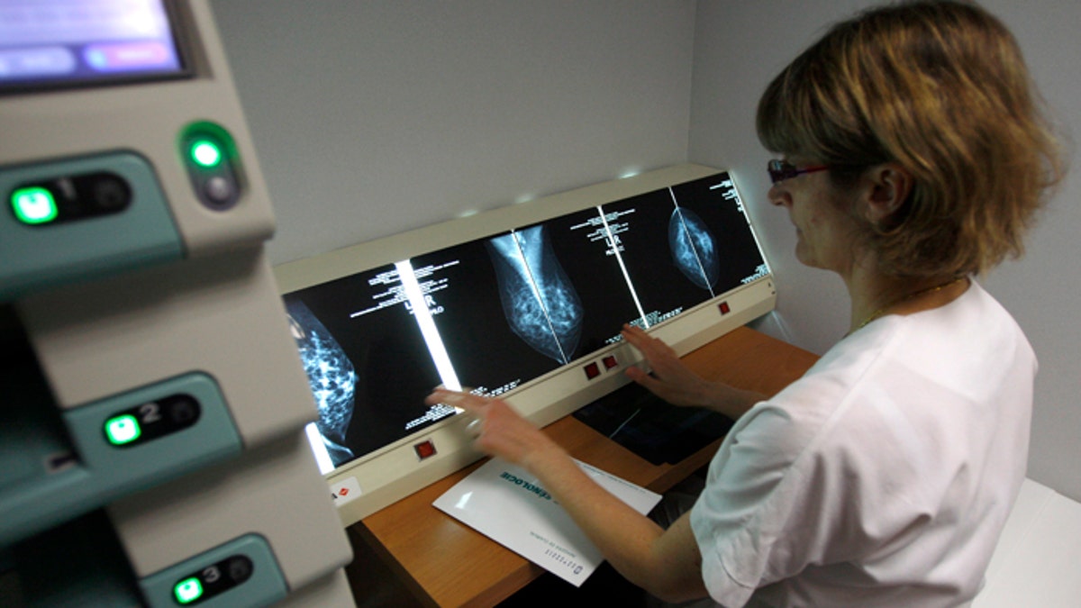 A radiologist examines breast X-rays after a cancer prevention medical check-up.
