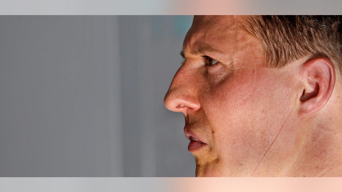 1b21e61f-France Schumacher Injured