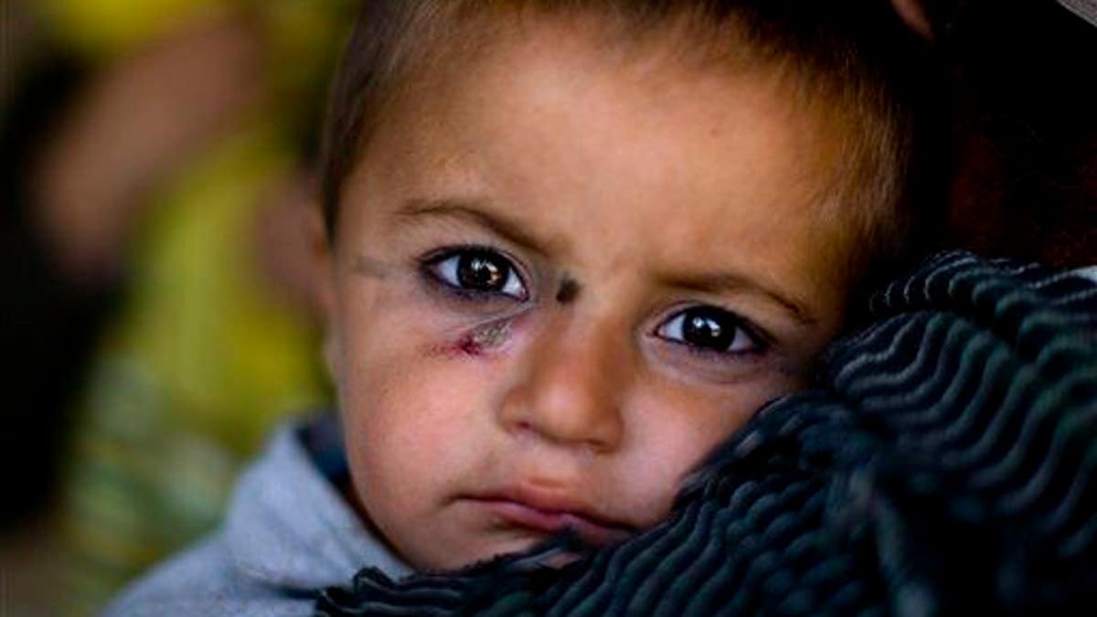 Afghanistan Disfiguring Disease