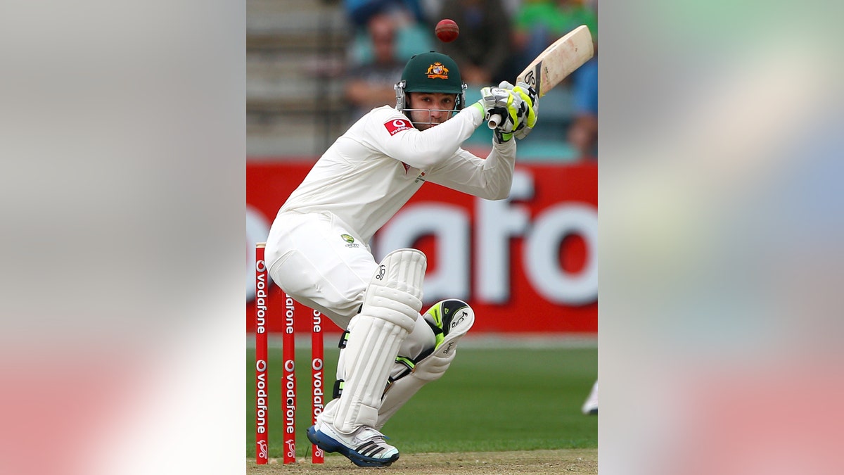 Australia Cricket Hughes Injured