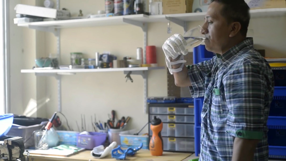 Man With No Hand Given New Prosthesis