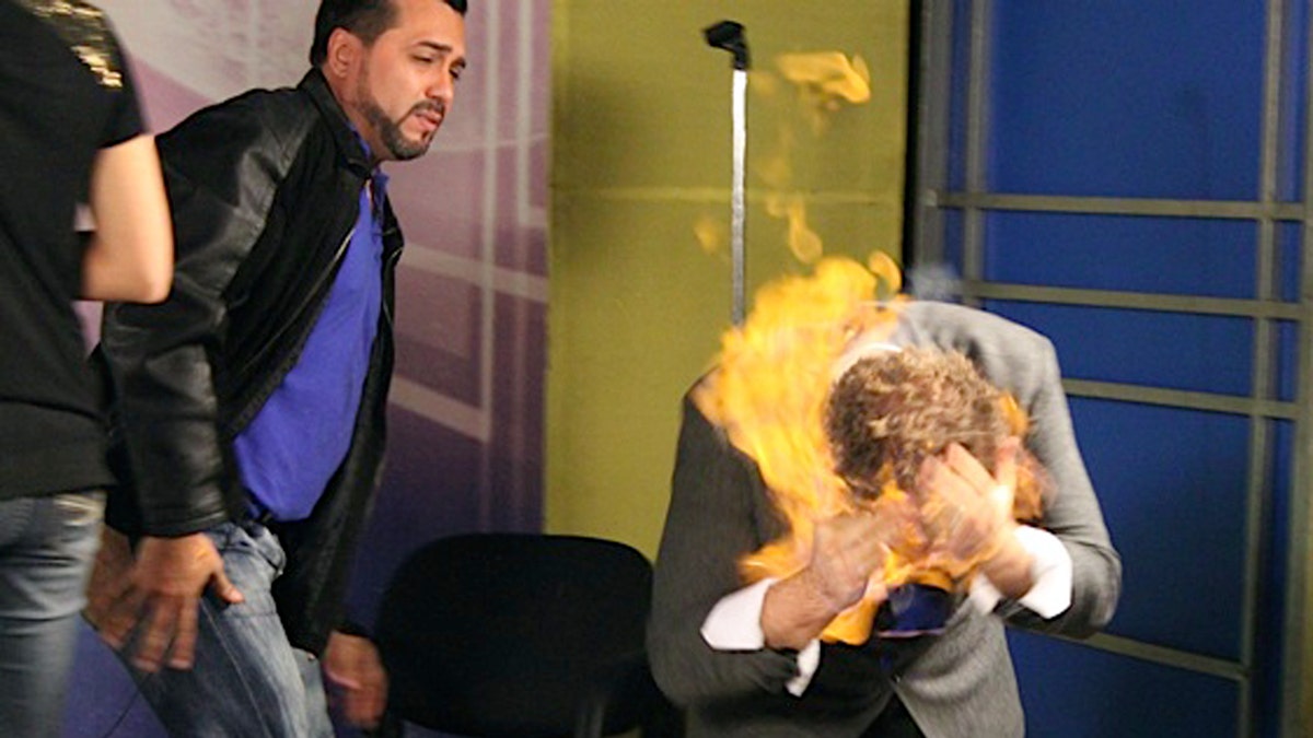 Dominican Republic US Magician Burned