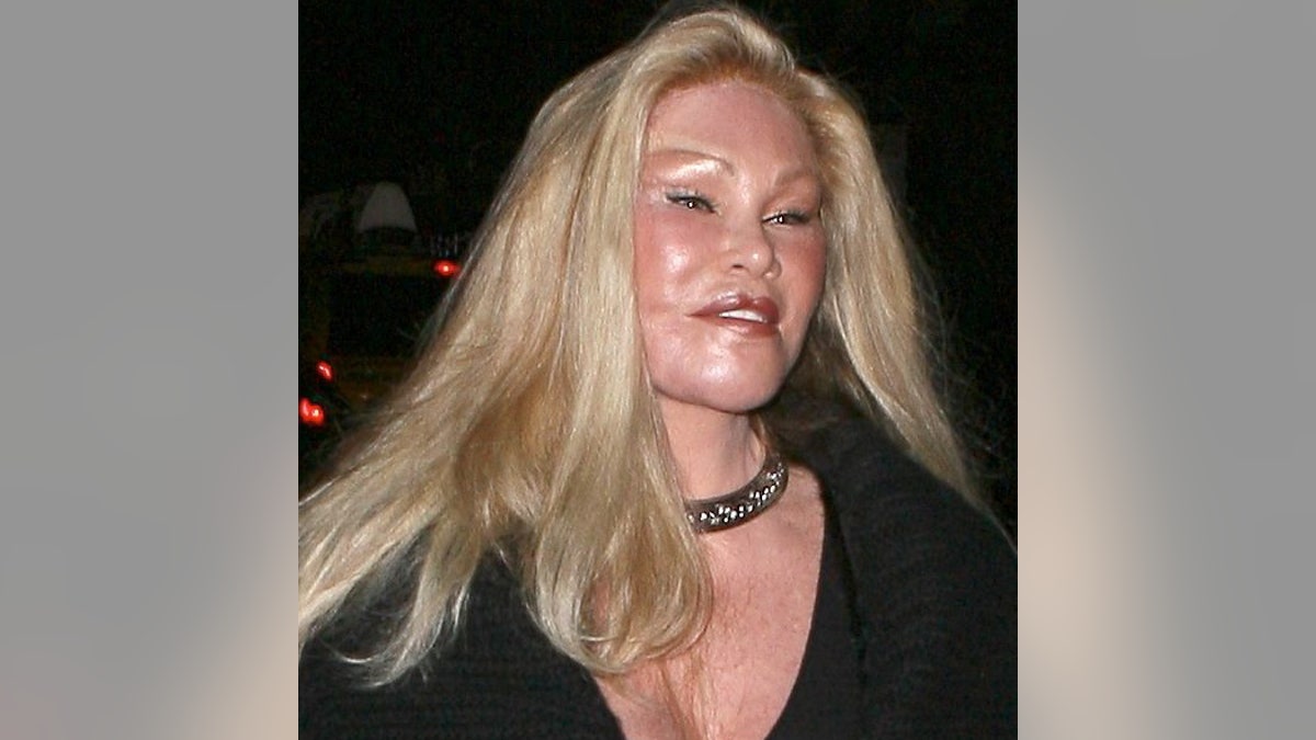 Jocelyn Wildenstein